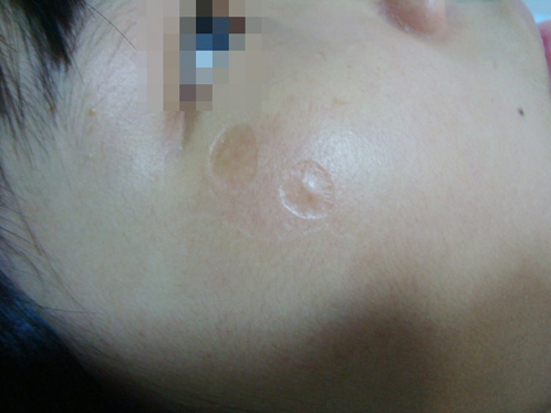 凹陷5.JPG 凹陷5.JPG