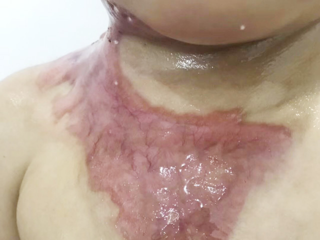 凹陷5.JPG 凹陷5.JPG